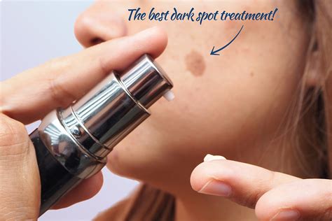 best dermatologist for dark spots.